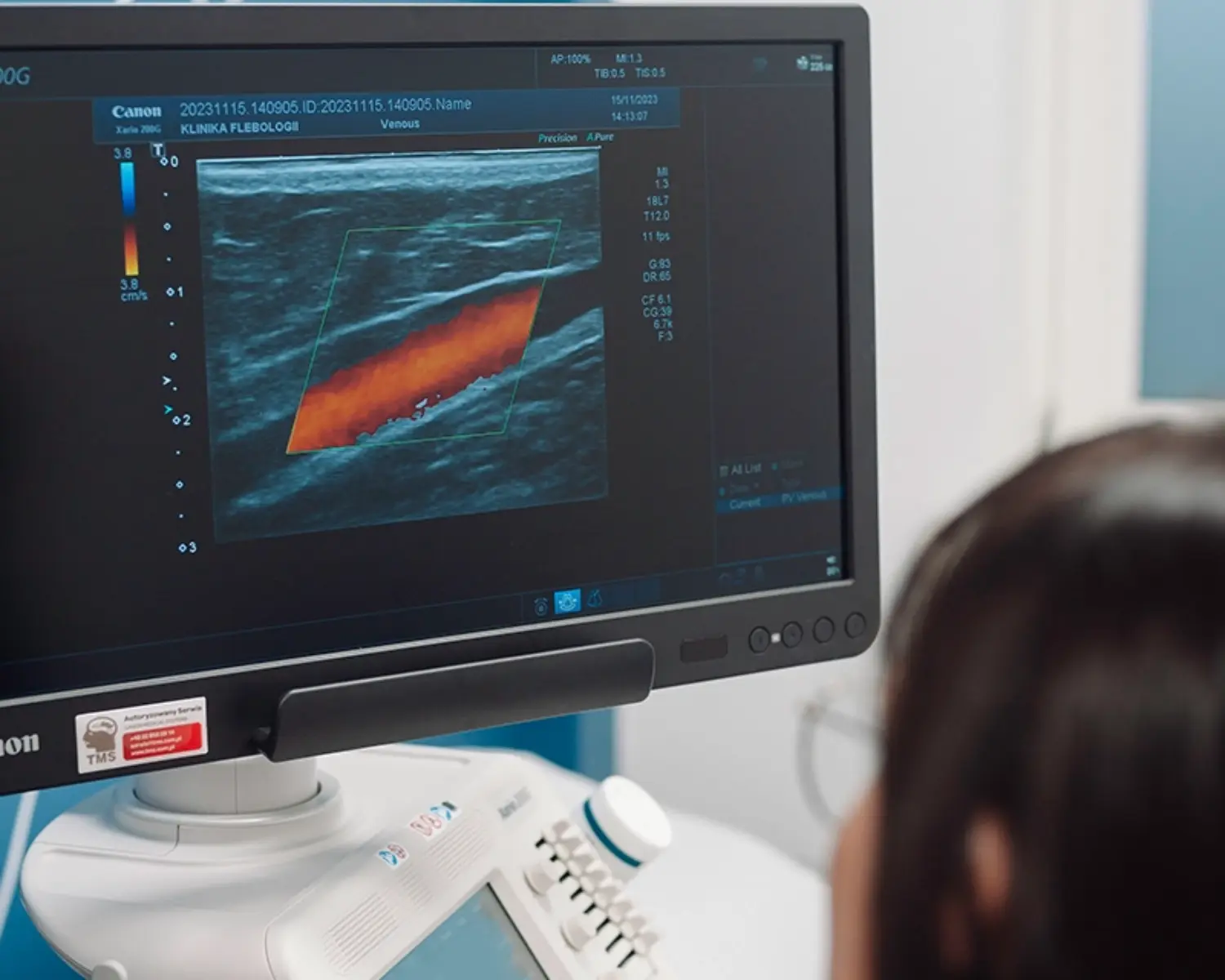 Badanie USG Doppler żył wykonywane w Klinice Flebologii w Warszawie.