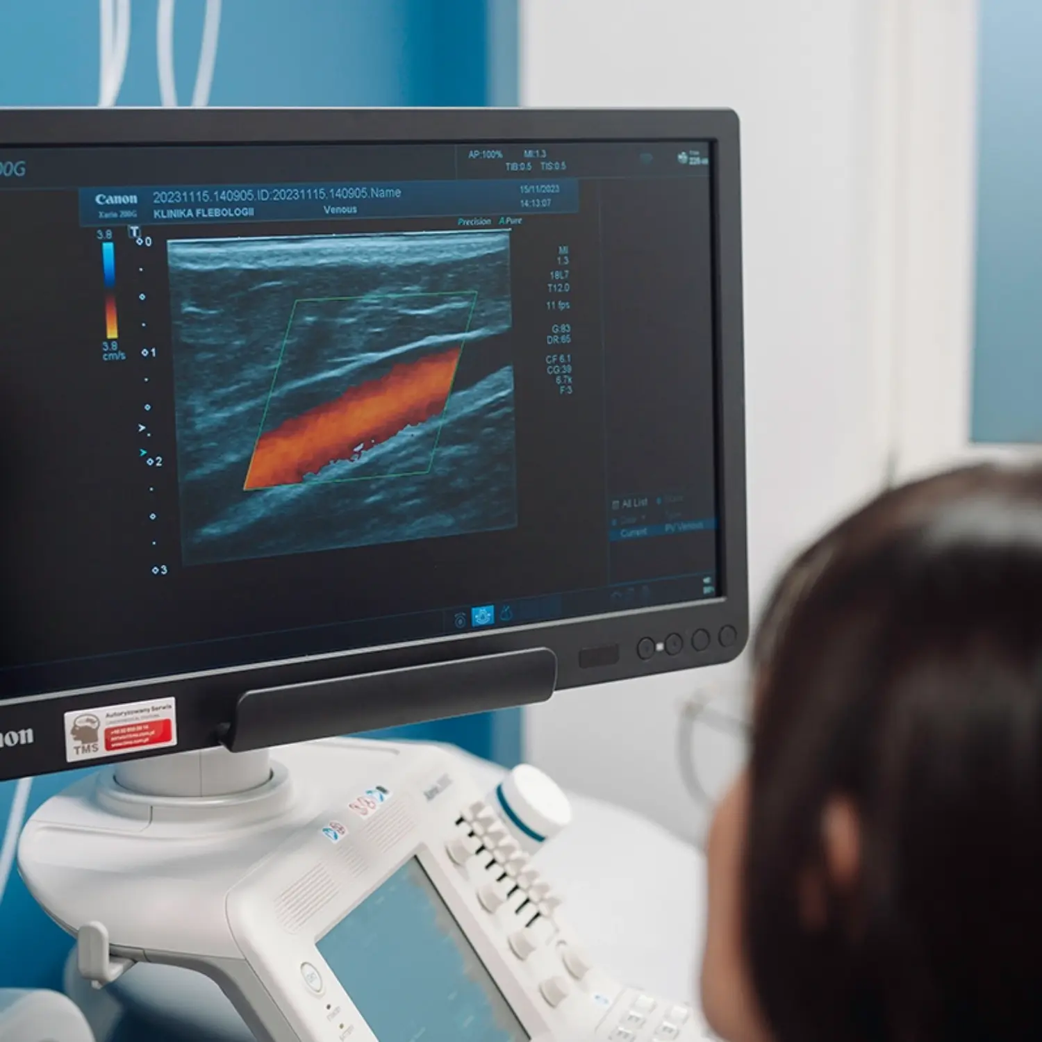 Badanie USG Doppler żył wykonywane w Klinice Flebologii w Warszawie.